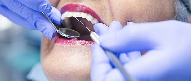 Best Walk-In Emergency Dental Services in Ham Lake, MN